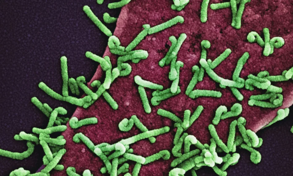 Plant-microbe and microbiome interactions